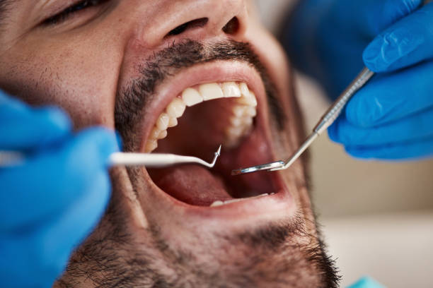 Best Emergency Treatment for Dental Infections or Abscesses in Malden, MO